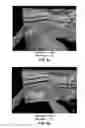 Fig. 07 - METHOD AND APPARATUS FOR DYNAMIC EXTRACTION OF EXTREMA-BASED GEOMETRIC PRIMITIVES IN 3D VOXEL VOLUMES