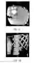 Fig. 07 - Targeting method, targeting device, computer readable medium and program element