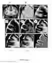 Fig. 06 - Method and system for characterizing cortical structures