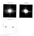 Fig. 04 - Radiological image processing apparatus and radiological image processing program