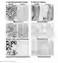 Fig. 01 - Systemic Administration of Chlorotoxin Agents for the Diagnosis and Treatment of Tumors