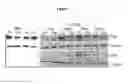 Fig. 08 - Compositions and methods for visualizing and eliminating cancer stem cells