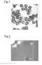 Fig. 02 - Microparticles comprising PCL and uses thereof