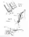 Fig. 02 - Doctor apparatus and a method for a web forming machine for doctoring a moving surface as well as a blade holder