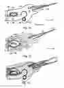 Fig. 06 - Doctor apparatus and a method for a web forming machine for doctoring a moving surface as well as a blade holder