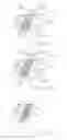 Fig. 07 - Refastenable Absorbent Article and a Method of Applying Thereof