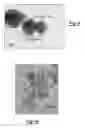 Fig. 05 - HOLLOW CARBON SPHERES