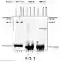 Fig. 08 - Genetic markers of the risk of developing restenosis