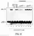 Fig. 09 - Genetic markers of the risk of developing restenosis