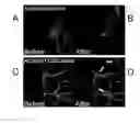 Fig. 01 - Low Level Fluorescence Detection at the Light Microscopic Level