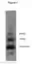 Fig. 02 - Compounds and methods for treating cancer