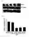 Fig. 02 - Combination Therapy for Neuroprotection