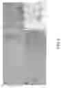 Fig. 09 - THERAPEUTIC AGENT FOR INTERSTITIAL PULMONARY DISEASE COMPRISING ANTI-HMGB-1 ANTIBODY