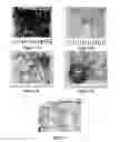 Fig. 02 - MAGNETIC INK TISSUE MARKINGS