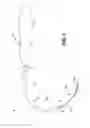Fig. 02 - IMPLANTABLE INTRODUCER