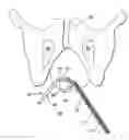 Fig. 01 - SURGICAL DEVICES AND METHODS FOR TREATING PELVIC CONDITIONS