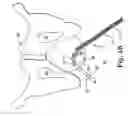 Fig. 06 - SURGICAL DEVICES AND METHODS FOR TREATING PELVIC CONDITIONS