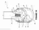Fig. 02 - Surgical tool for measurement of valve annulus and cusp geometry