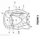 Fig. 06 - Surgical tool for measurement of valve annulus and cusp geometry