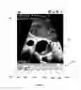 Fig. 06 - MEDICAL DIAGNOSTIC DEVICE USER INTERFACE