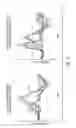Fig. 05 - Recognizing awareness in an anesthetized subject