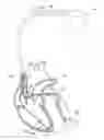 Fig. 01 - Methods and systems to correlate arrhythmic and ischemic events