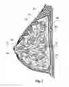 Fig. 02 - Measuring Fluid Excreted from an Organ