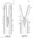 Fig. 08 - Methods and Systems for Performing Submucosal Medical Procedures