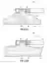 Fig. 15 - Methods and Systems for Performing Submucosal Medical Procedures