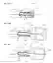 Fig. 19 - Methods and Systems for Performing Submucosal Medical Procedures
