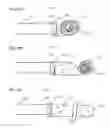 Fig. 22 - Methods and Systems for Performing Submucosal Medical Procedures