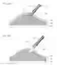 Fig. 52 - Methods and Systems for Performing Submucosal Medical Procedures