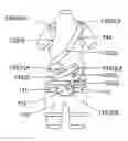 Fig. 01 - Spinal orthosis