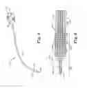 Fig. 04 - Catheter systems having flow restrictors