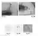 Fig. 07 - Device for administering an at least two-component substance