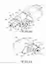 Fig. 11 - Partially implantable medical devices and methods