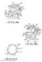 Fig. 23 - Partially implantable medical devices and methods
