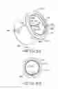 Fig. 24 - Partially implantable medical devices and methods