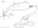 Fig. 01 - DEVICES AND METHODS FOR PERCUTANEOUS ENERGY DELIVERY