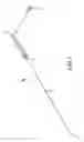 Fig. 02 - Medical device having laminate-coated braid assembly