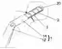 Fig. 01 - ANTI-SUBSIDENCE DYNAMIC HIP SCREW