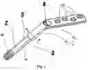 Fig. 02 - ANTI-SUBSIDENCE DYNAMIC HIP SCREW