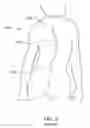 Fig. 04 - Non-invasive adjustable distraction system