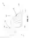Fig. 12 - Method and apparatus for a radiolucent and MRI compatible cranial stabilization pin