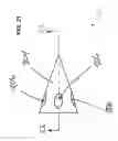 Fig. 22 - Method and apparatus for a radiolucent and MRI compatible cranial stabilization pin