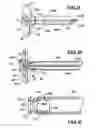 Fig. 06 - Surgical connector systems and methods of use