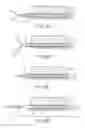 Fig. 20 - Living tissue ligation device