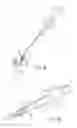 Fig. 34 - Living tissue ligation device