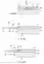 Fig. 49 - Living tissue ligation device