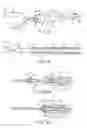 Fig. 32 - Living tissue ligation device